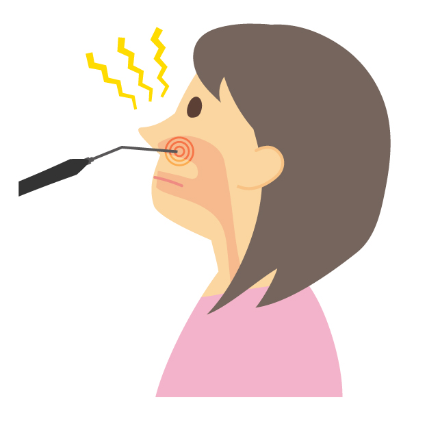 CO2レーザー手術